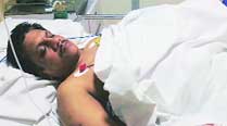 Engineer shot and injured for foiling chain-snatching bid