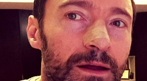 Hugh Jackman treated for skin cancer on nose again