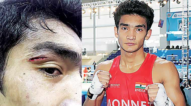 Thapa’s cut (L), above his right eye was caused after Rao’s elbow hit him.