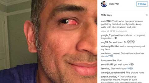 MS Dhoni hit by bail, continued to keep wickets with  ‘blurred vision and pain’