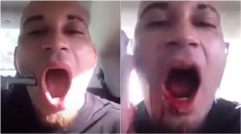 Video Wannabe Rapper Shoots Himself In The Face Just So His Video