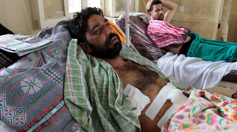 A wounded Kashmiri lies on a bed, after being hit by pellets during a protest, at a hospital in Srinagar. 