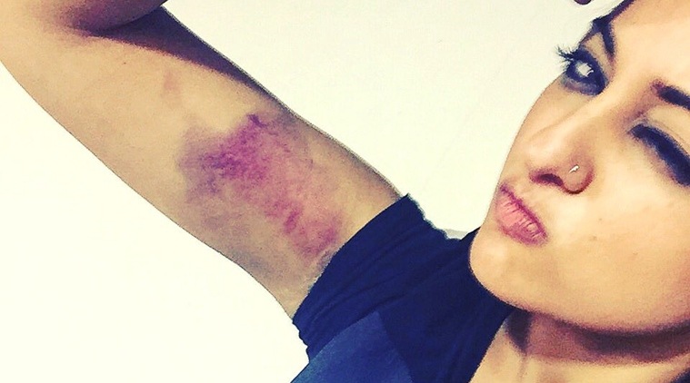 Akira, Sonakshi Sinha, Akira Sonakshi Sinha, Sonakshi injured, Sonakshi Sinha injured