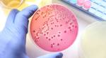 Gut bacteria linked to stroke, dementia: Study