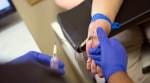 Nine of 194 countries keeping pledge to eradicate hepatitis: WHO summit
