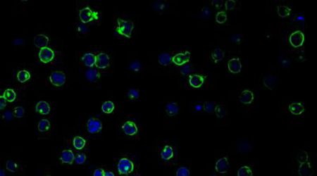 Scientists identify new, more effective way to treat HIV