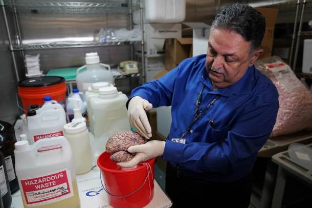 Human brains, Brains, brains in the bronx, New York, Brain hospital, New York brain hospital, brain photos