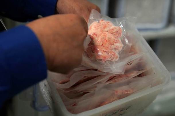 Human brains, Brains, brains in the bronx, New York, Brain hospital, New York brain hospital, brain photos