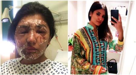 This acid attack survivor’s incredible post-recovery photos are every bit inspiring