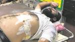 Chandigarh: Argument over swing installation at park, man stabbed several times