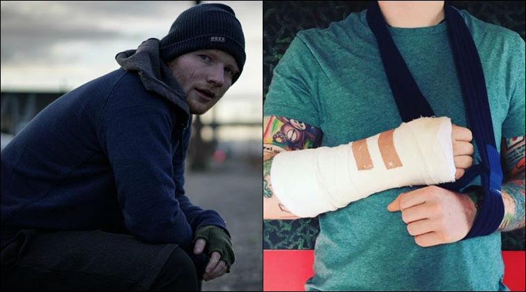 ed sheeran, ed sheeran injury, ed sheeran accident, ed sheeran army injury, ed sheeran bike accident, entertainment news, indian express news