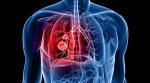 Lung, breast leading cancers in Chandigarh in 2013- 2014: Report