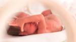More newborn boys admitted than girls in paediatric ICUs: Data