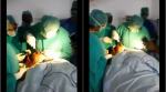 Viral Video: Here's why Guntur doctors were forced to operate using mobile phone torch light