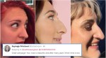 #SideProfileSelfie: Woman starts Twitter campaign to break the BIG NOSE taboo