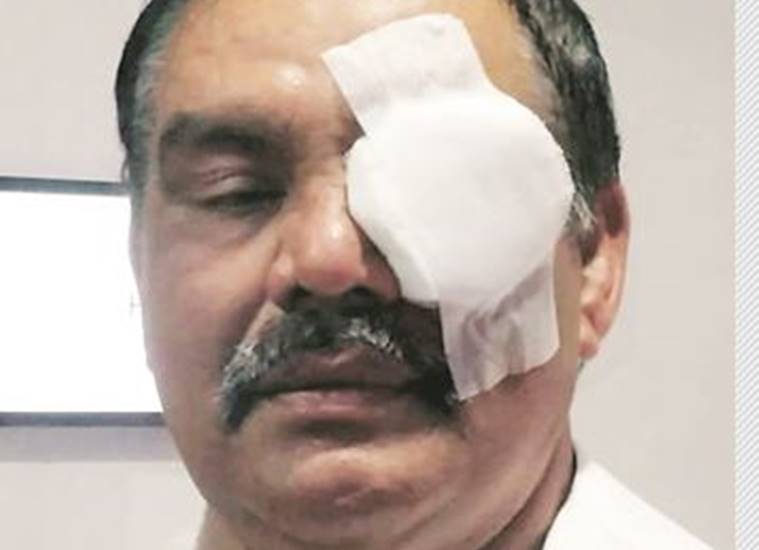 chandigarh police, police use water cannons, shiromani akali dal protest, sad supporters protest, punjab assembly protest, punjab news, vijay sampla