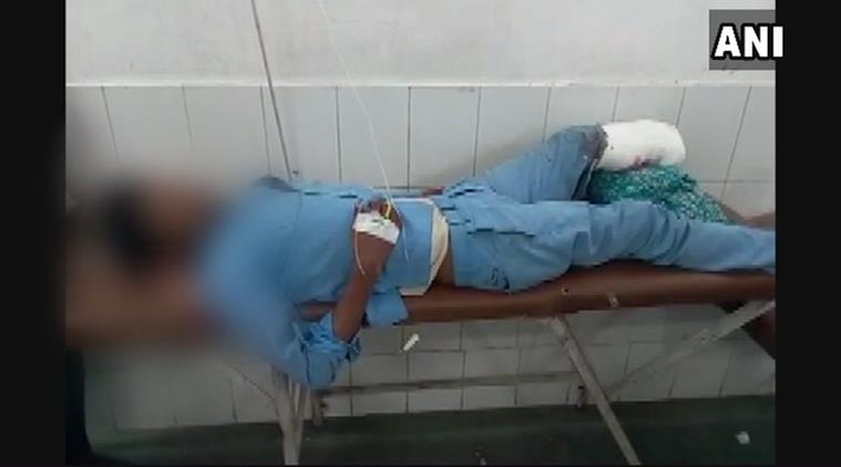 Severed leg used as pillow: NHRC issues notice to Uttar Pradesh govt, seeks report in a month