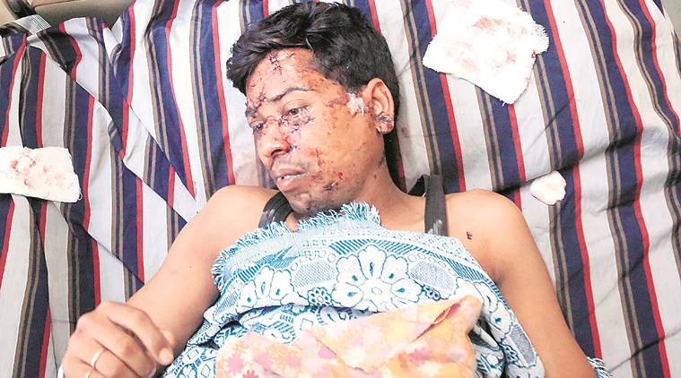 Tarapur fire survivor