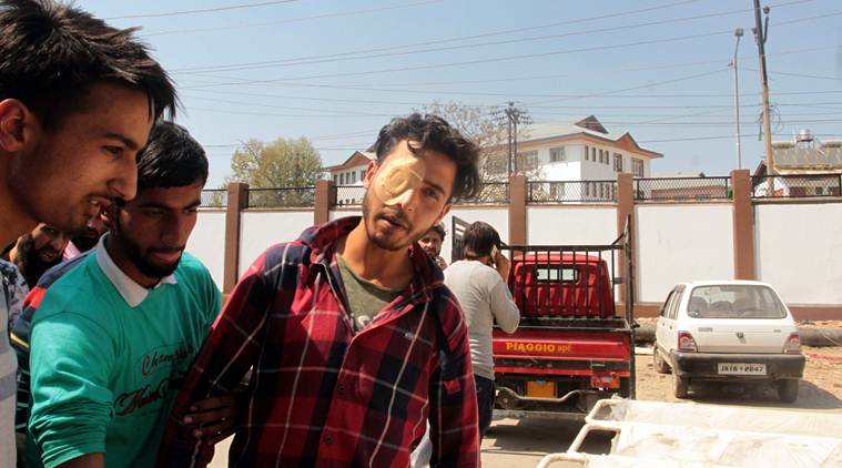 An injured person outside SMHS hospital in Shopian district on Sunday. (Express photo/Shuaib Masoodi)