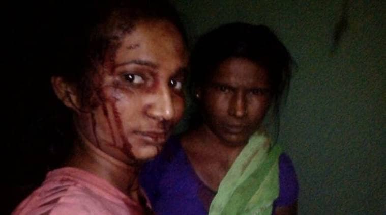 Maharashtra: Trying to save goat, woman fights off tiger with a stick