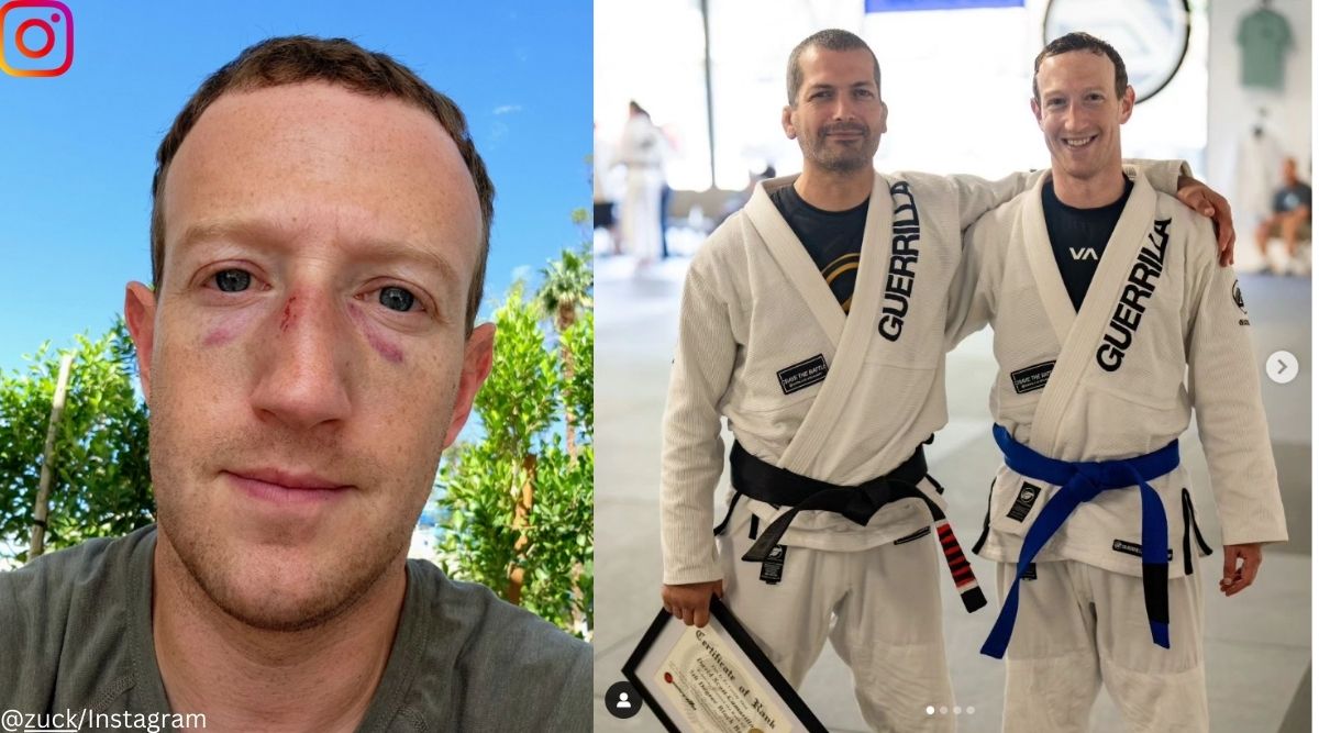 Meta Ceo Mark Zuckerberg Posts Selfie With Sparring Bruises On Face