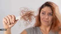 Myth or fact: Coffee may be a reason behind hair loss in women