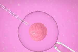 Stem cells determine our level of creativity | Health News - The Indian ...