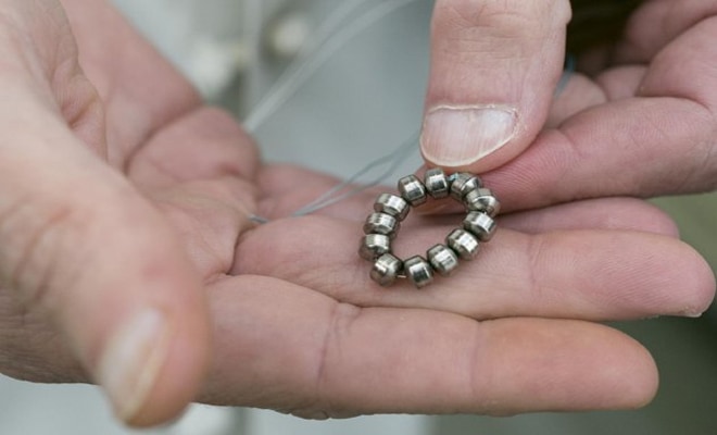 Implanted ‘bracelet’ helps treat chronic heartburn | Health News - The ...