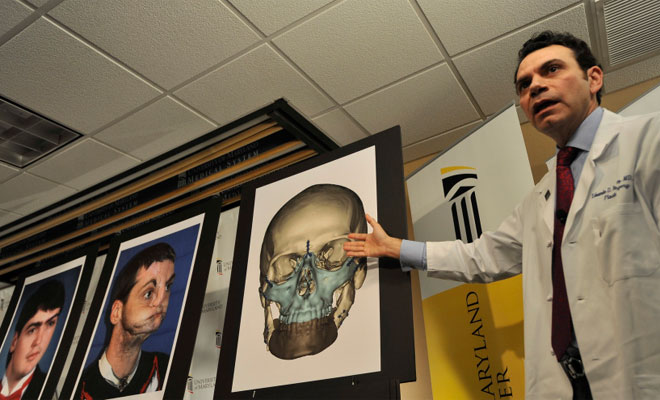 Human Head Transplants Now Possible Claims Italian Health News The