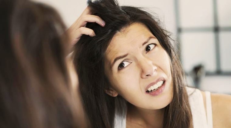 home remedies for fighting dandruff, fight dandruff with kitchen items, curd for dandruff, lemon for dandruff, hair health, hair scalp, dandruff, indian express, indian express news