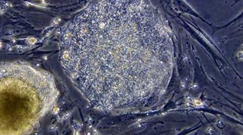 The researchers have created a more advanced material that targets specific cells and provides clear signals to these cells to enhance regeneration. (Source: PTI photo)