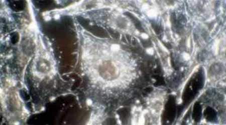The cells helped even if given a month after the event and whether introduced directly into the brain or injected via a blood vessel.