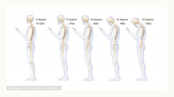 spine-main