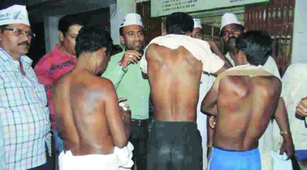 Tribals show their injury marks. (Express)
