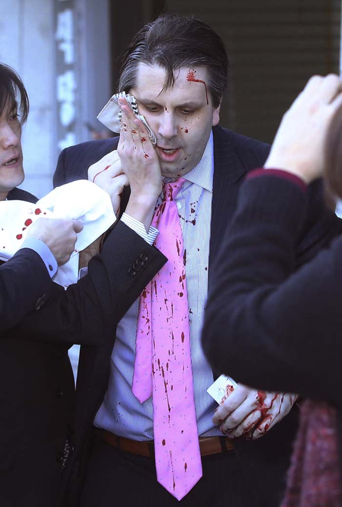 south korea attack, mark lippert attack, US ambassador attack, US envoy attack, US ambassador Mark Lippert, South Korea, south korea Knife attack, south korea news, asia news, world news, picture gallery, indian express