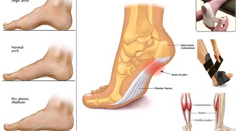 treat painful foot condition 