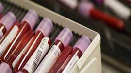 Haemophilia patient, Haemophilia, KEM hospital, Haemophilia patient dies, indian express news  