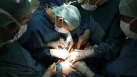 Sion hospital, kidney transplant, illegal kidney transplant, kidney stolen, mumbai kidney stolen,indian express news, mumbai, mumbai news