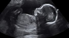 haryana, haryana female foeticide, sex determination, illegal sex determination, female foeticide, PCPNDT act, PNDT act, Haryana government, haryana pcpndt, haryana sex determination, haryana news