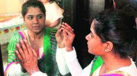 free medical treatment, acid attack, acid attack order, mumbai news, city news, local news, mumbai newsline