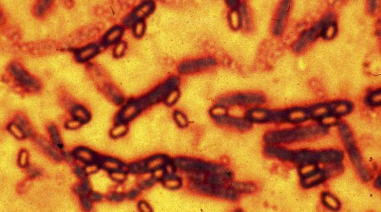 Us Military Mistakenly Ships Live Anthrax To Labs In Nine States World News The Indian Express 6676