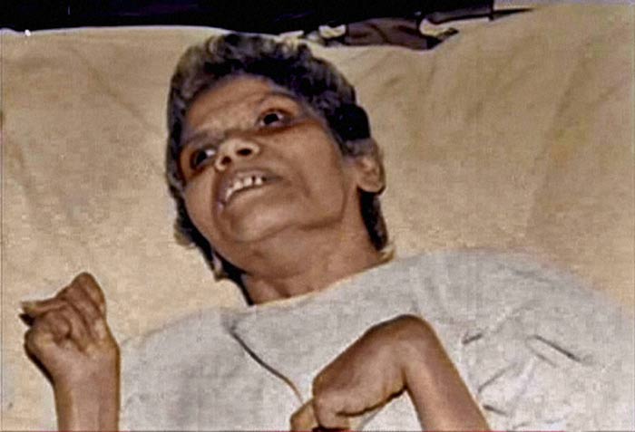 Aruna Shanbaug, Aruna Shanbaug death, Aruna Shanbaug coma, Aruna Shanbaug mumbai, euthanasia Aruna Shanbaug, Aruna Shanbaug vegetative state, mumbai 1973 rape case, 1973 rape case, Aruna Shanbaug raped, mumbai nurse aruna shaunbag, Aruna Shanbaug KEM nurse, Aruna Shanbaug 42 years coma, Aruna Shanbaug expired, Aruna Shanbaug nurse, mumbai news, india news, indian express