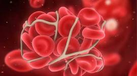 blood clot, blood clot bust, drug, blood clot drug, imtech, research, science, india science. science news
