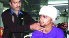kashmir police hits boy, kashmir police, Kashmir protests, Palhallan protests, kashmir police, kashmir pellet guns, kashmir boy blinded, Hamid Nazir, jnk news, j&k news, jammu kashmir news, kashmir news, India news