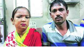 kidney woman, kidney damage, delhi govt, kidney transplant, Hepatiti C, End Stage Renal Disease , delhi news, local news, city news, Indian Express