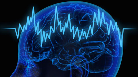 Rare technique used to save woman with brain haemorrhage