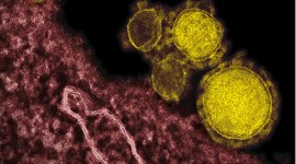 mers virus, saudi arabia, mers saudi arabia, mers virus saudi arabia, mers saudi, mers deaths, mers saudi deaths, mers patients, mers latest news, saudi news