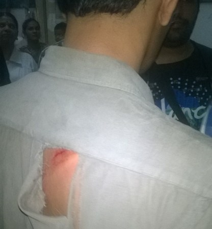 kem, kem doctors, kem doctors strike, mumbai, mumbai dengue, mumbai dengue death, kem strike, kem hospital strike, kem hospital doctor strike, mumbai news, city news