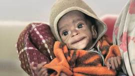 Malnutrition, India Malnutrition, Nutrition report, Global Nutrition Report, India malnutrition level, Ministry of Women and Child Development, RSOC, Food Policy Research Institute, IFPRI, malnutrition in children, Global Nutrition Report 2015, Nutrition Report 2015, International Food Policy Research Institute, Indian express