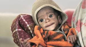 Simply put: Lost in fog of disparate data, a picture of India’s nutrition